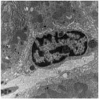 Transmission electron microscopy of mouse liver.